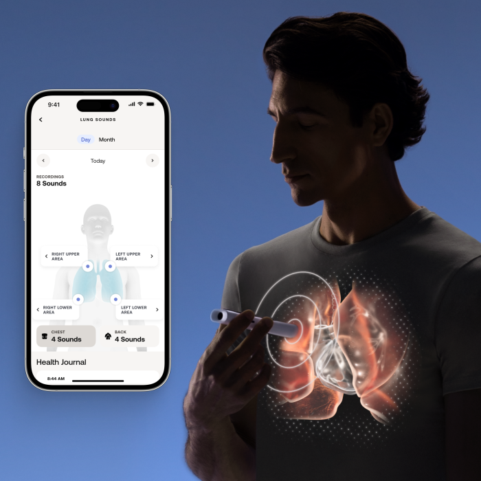 Withings BeamO
