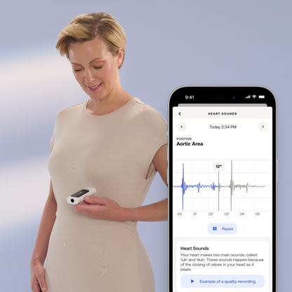 Withings BeamO